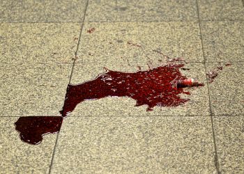 Woman bites her boyfriend’s penis during an argument