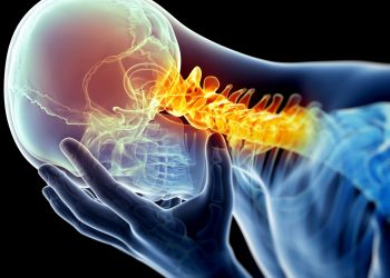 What you need to know about Migraine