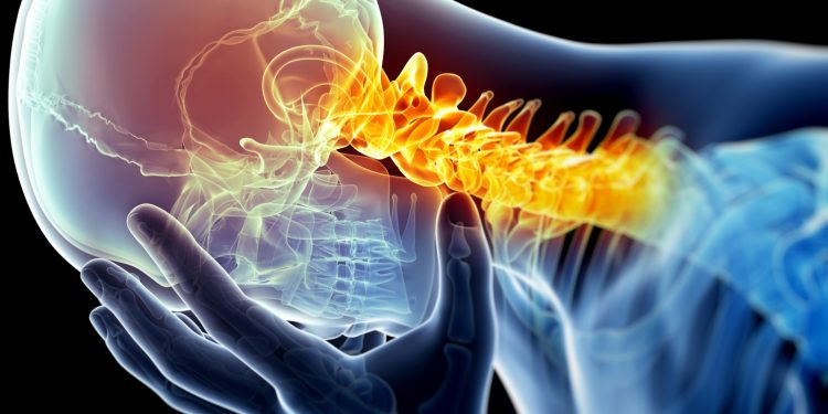 What you need to know about Migraine