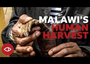 Watch: Malawi’s Human Harvest – Full documentary – BBC Africa Eye