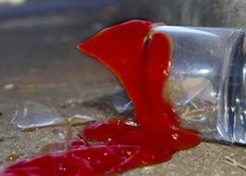 Man in critical condition after being stabbed with a broken glass