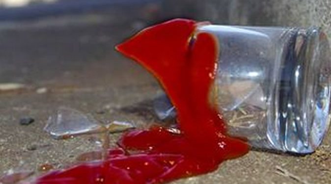 Man in critical condition after being stabbed with a broken glass