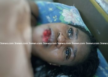 Jealous girlfriend chews lip of suspected rival in Takoradi