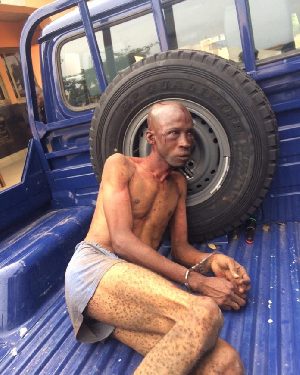 Nigerian kidnapping suspect was wrongly accused and beaten – Police