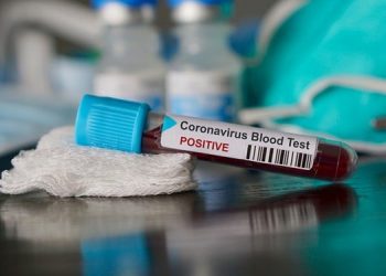 Coronavirus cases in Ghana rise to 27, two deaths