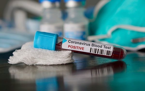 Coronavirus cases in Ghana rise to 27, two deaths