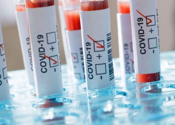 Ghana’s Coronavirus cases jump to 5,638; recoveries rise to 1,460