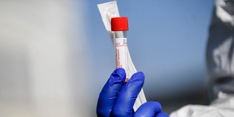 Coronavirus: ‘This virus may never go away,’ WHO says