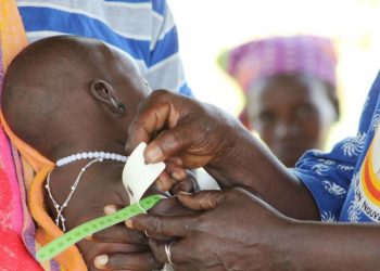 Half a million Burkinabè children severely malnourished
