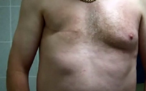 Breast cancer among men on the rise, voluntary screening crucial – GHS