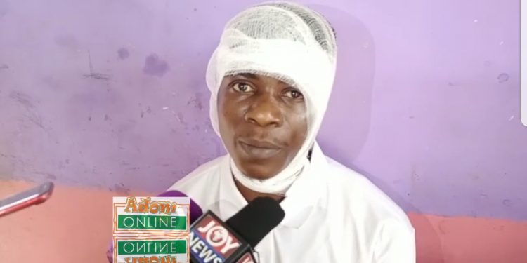 Policeman beats barber to pulp for ‘wooing’ his daughter