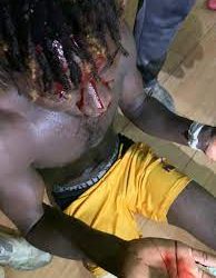 Medeama bus attacked with midfielder Eric Kwakwa in need of stitches after shocking Karela United fans attack