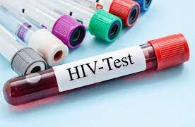 Single women contributed more to the spike in HIV/AIDS than men – Study