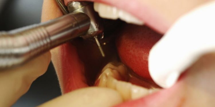 Dentist found guilty of intentionally damaging patients’ teeth to make more money