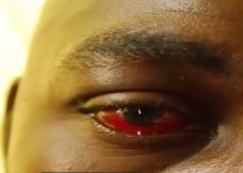 Wa flogging victims: Male lover fears losing sight; lady unable to go to work