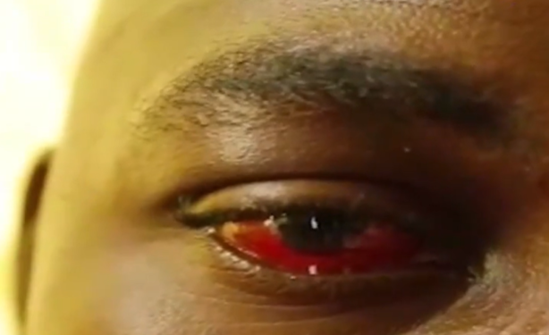 Wa flogging victims: Male lover fears losing sight; lady unable to go to work