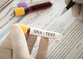 Man finds out his 10-year-old son isn’t his after doing DNA test