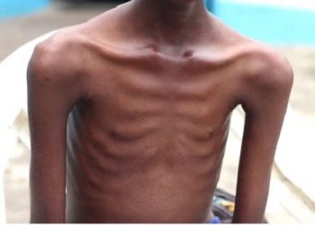 23,495 people infected with HIV/AIDS from January to June