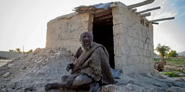 Iranian man who didn’t bath, brush his teeth for half a century dies after bathing