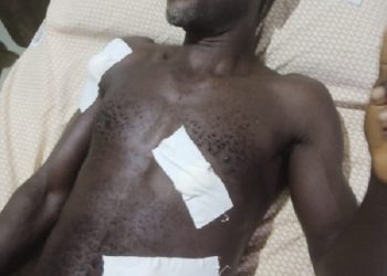 Hunter shoots palm wine tapper after mistaking him for a deer