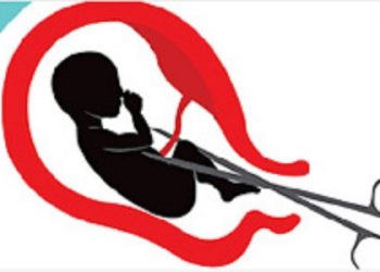 Teenager in critical condition after aborting 8-month pregnancy