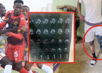 ‘Nana Yaw Amponsah has blocked me’ – ACL-stricken ex-Asante Kotoko striker cries out for help
