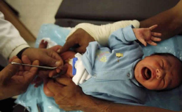 835,000 Ghanaian men uncircumcised – GSS report