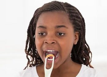 Signs of candidiasis in the mouth