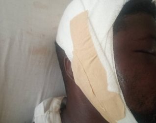 Man beaten over missing genitals at Senya Bereku 