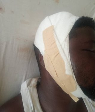 Man beaten over missing genitals at Senya Bereku