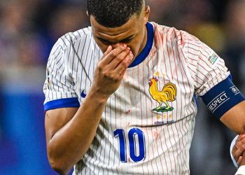 Mbappe ‘not doing well’ after nose injury