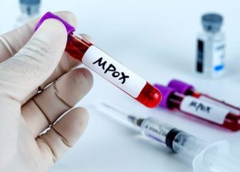Mpox cases rise to 170 with 7 new infections