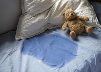 7-year-old girl suffers severe burns after guardian allegedly punishes her with heated spoon