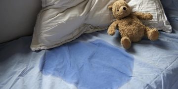 7-year-old girl suffers severe burns after guardian allegedly punishes her with heated spoon