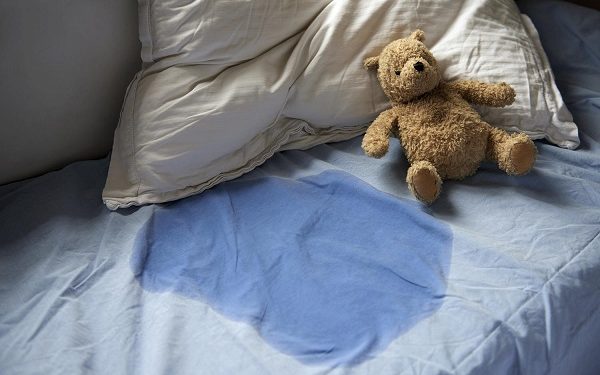 7-year-old girl suffers severe burns after guardian allegedly punishes her with heated spoon