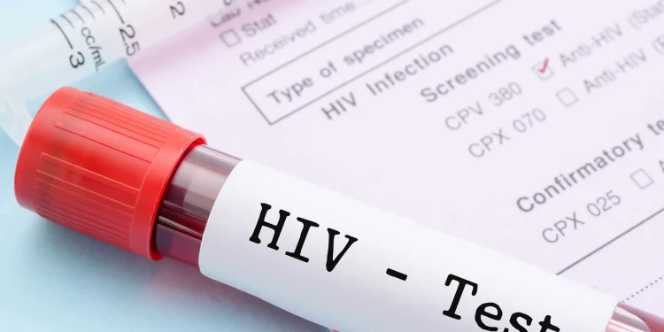 Ghana records 42 new HIV infections every day – AIDS Commission